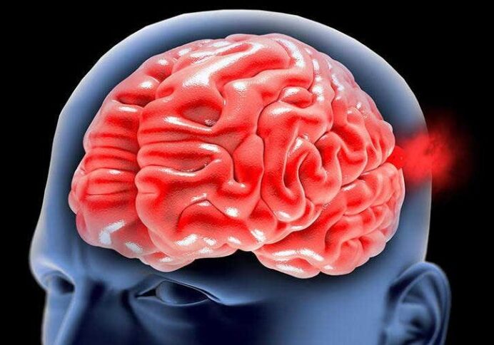 Red brain graphic in blue head